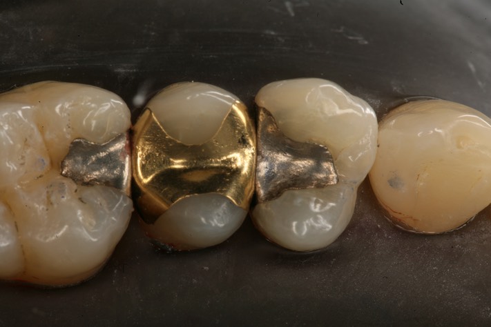 Brandon Yokota #12 pre-op with dam