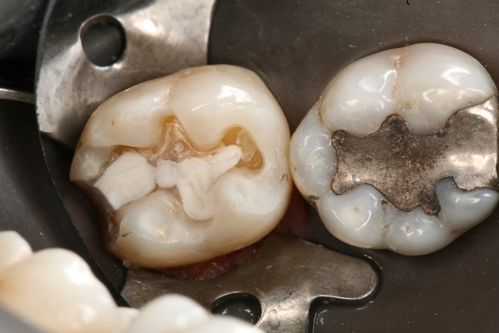 Ted Kanamori #31 prep