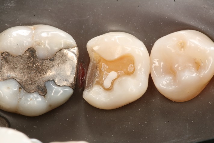 Ted Kanamori #29 prep