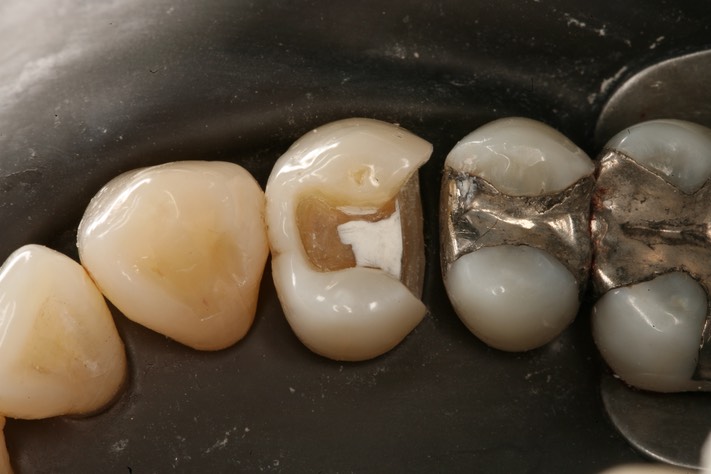 Carla Fukumoto #5 prep