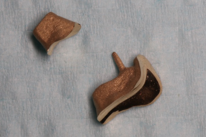 10Kyle Chock #14 castings