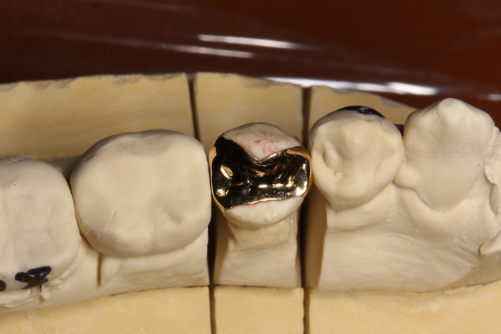 15Mark Chun #20 casting