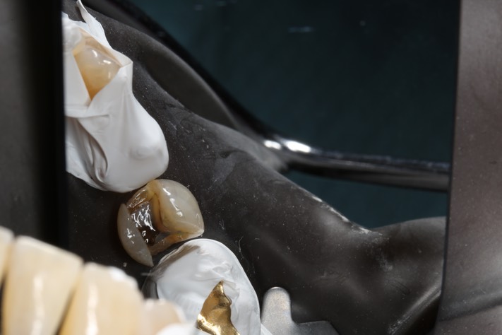 17Mark Chun #20 prep