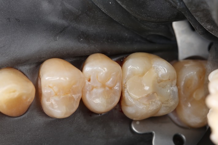 19Matt Dodson #3 pre-op