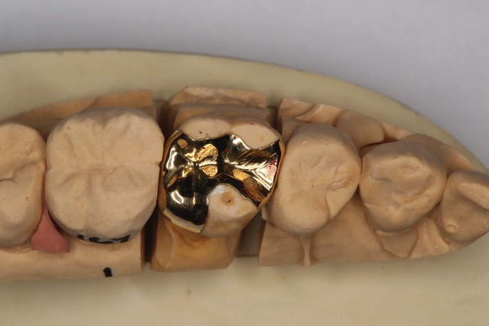 Frank Fukuda #3 on model