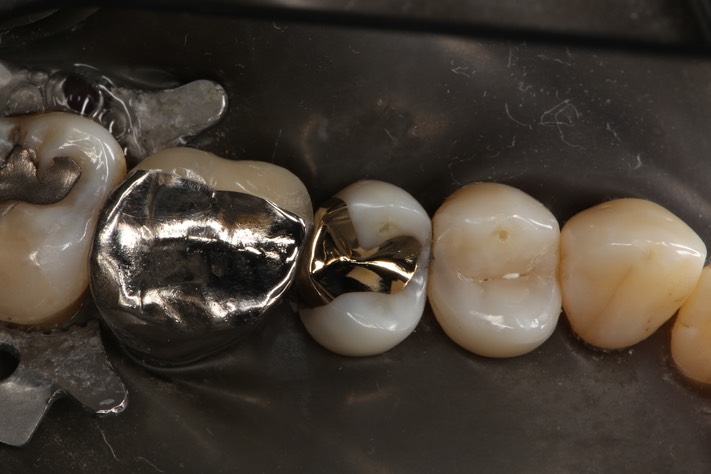 Kyle Chock #4 finish