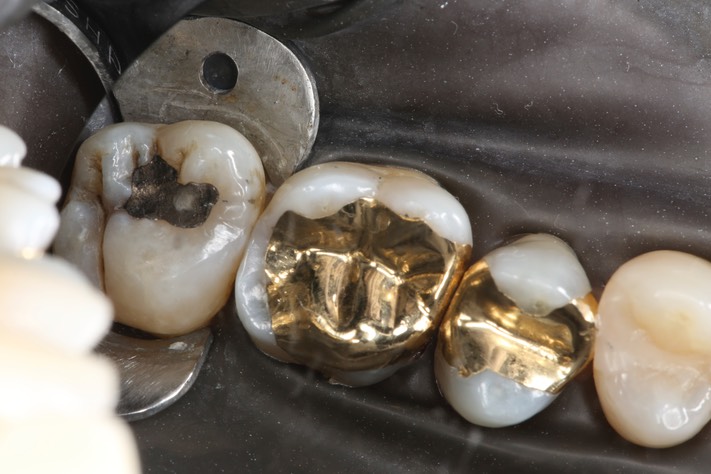 Wayne Chin #14 finish