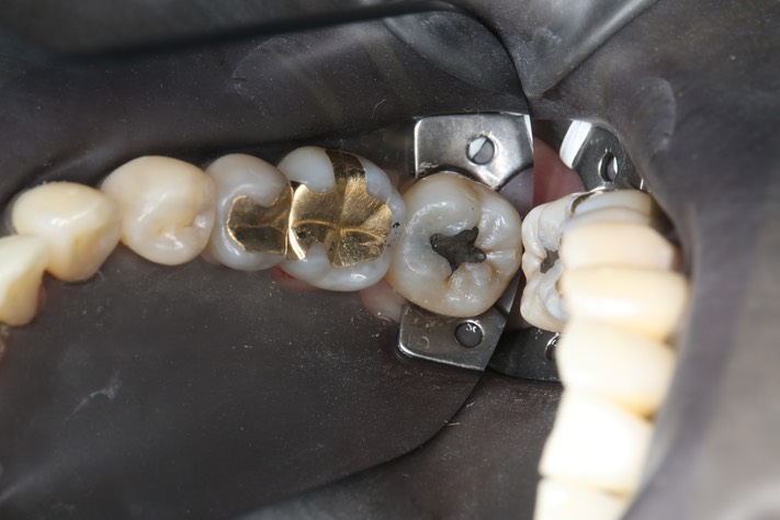 Chris Woo #18 pre-op