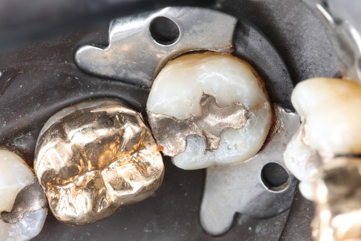 Russ Tabata #18 pre-op