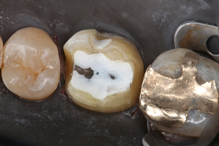 Ted Kanamori #19 prep