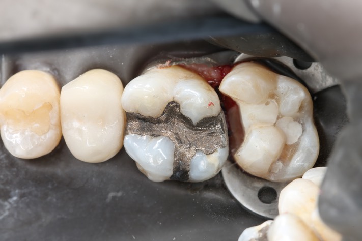 Larry Fujioka #2 prep