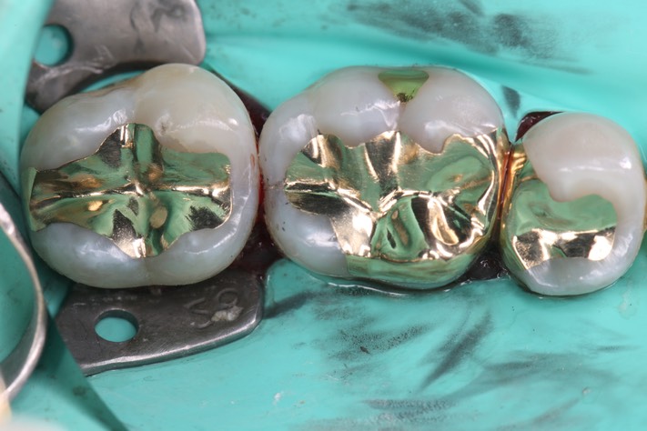 Gary Umeda #29, 30, 31 finish