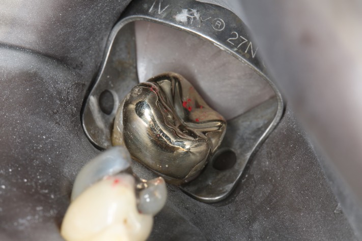 Scott Kanamori #31 try in