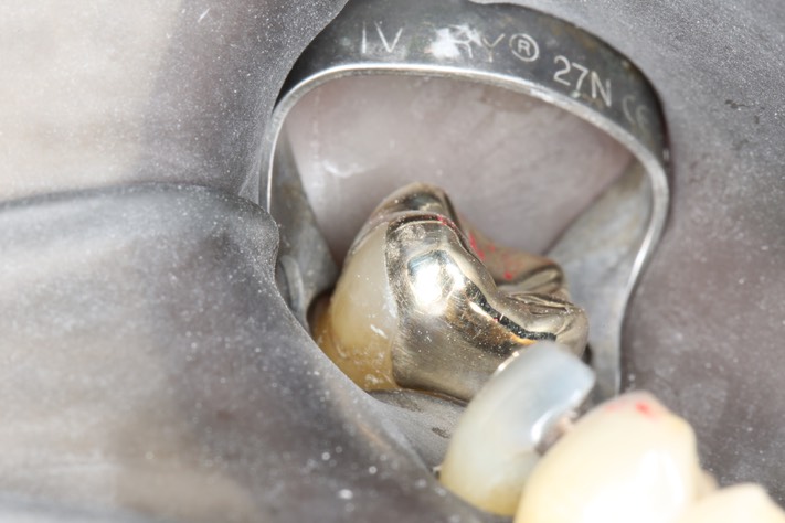 Scott Kanamori #31 try in