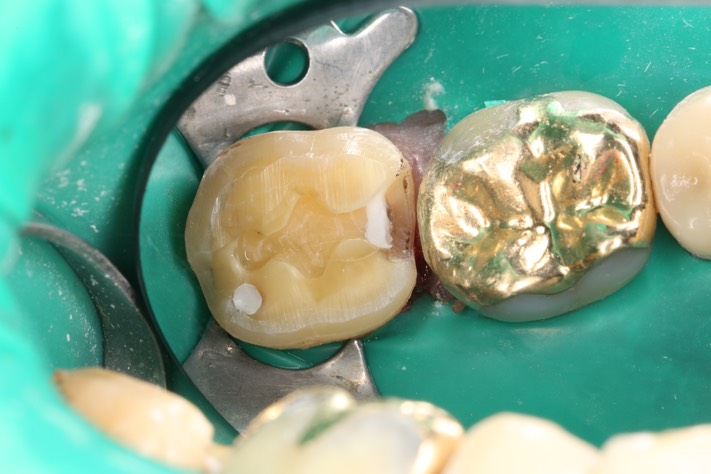 Alan Tamashiro #31 prep