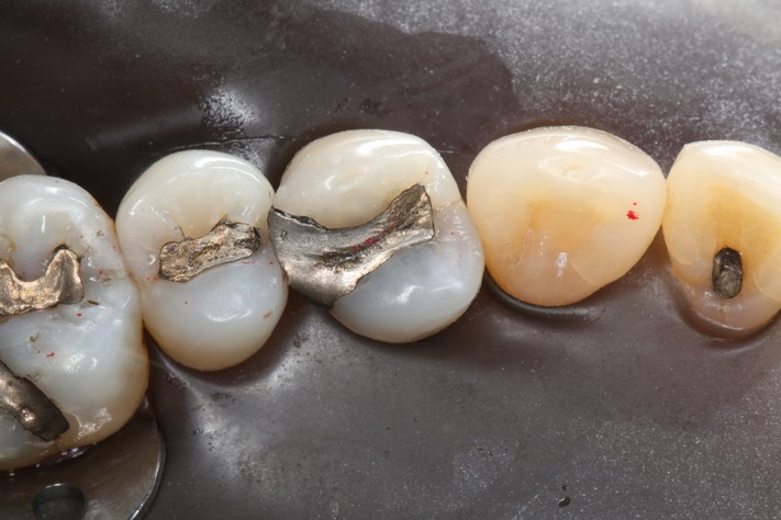 Alan Chinn #12 pre-op