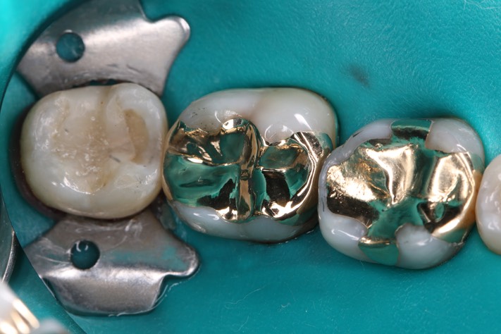 Mark Chun #31 finish