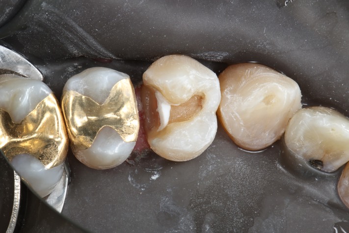 Alan Tamashiro #12 prep