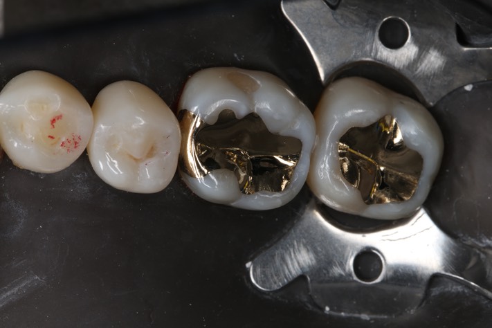 Ted Kanamori #18 - 19 finish