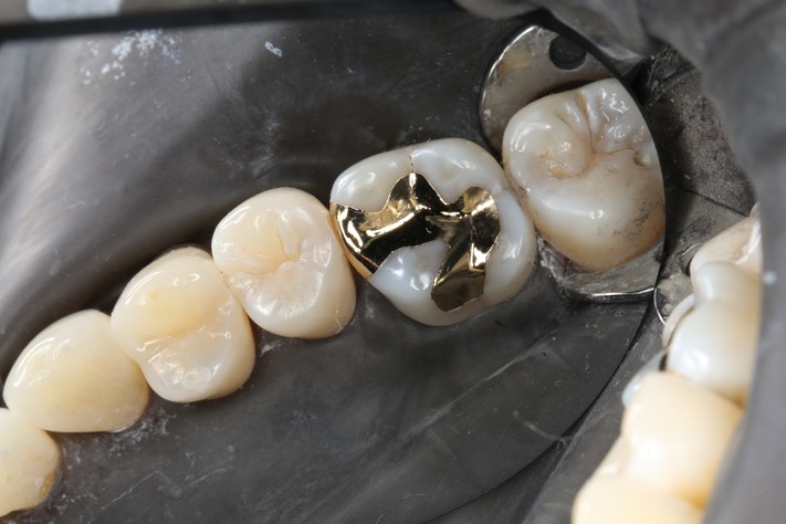 Kyle Chock #3 finish