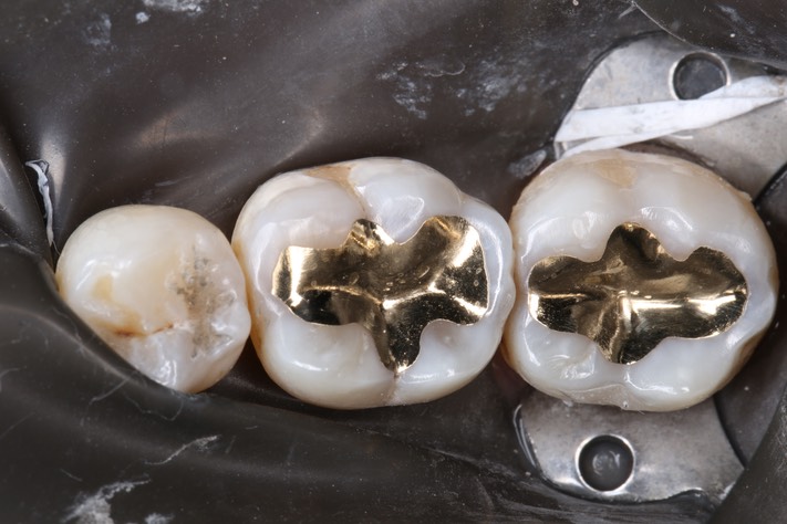 Chris Woo #18 - 19 finish