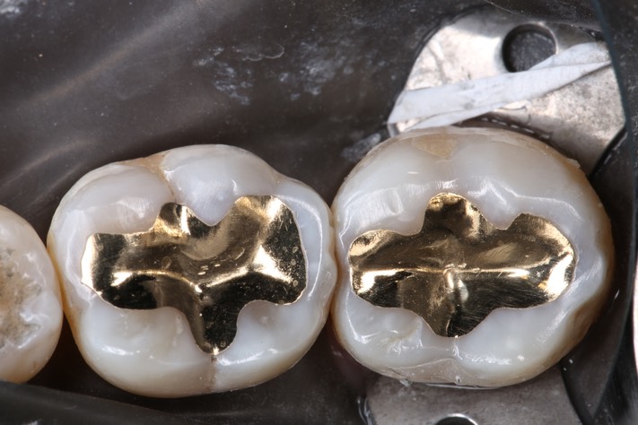 Chris Woo #18 - 19 finish