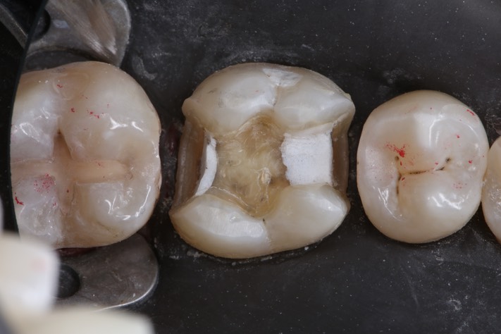 Scott Kanamori #30 prep