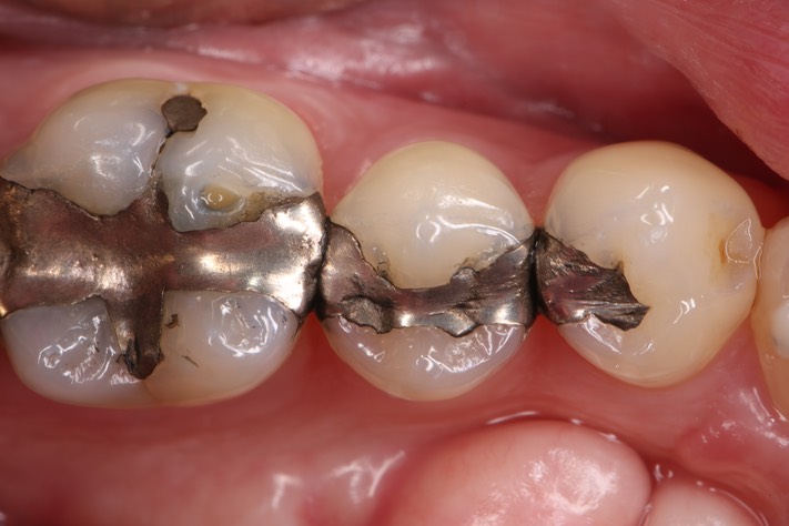 Gary Umeda #30 pre-op