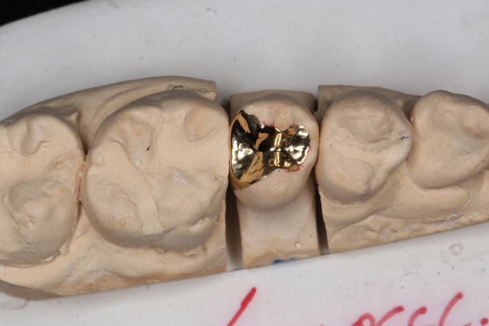 Mitchell Chun #4 casting