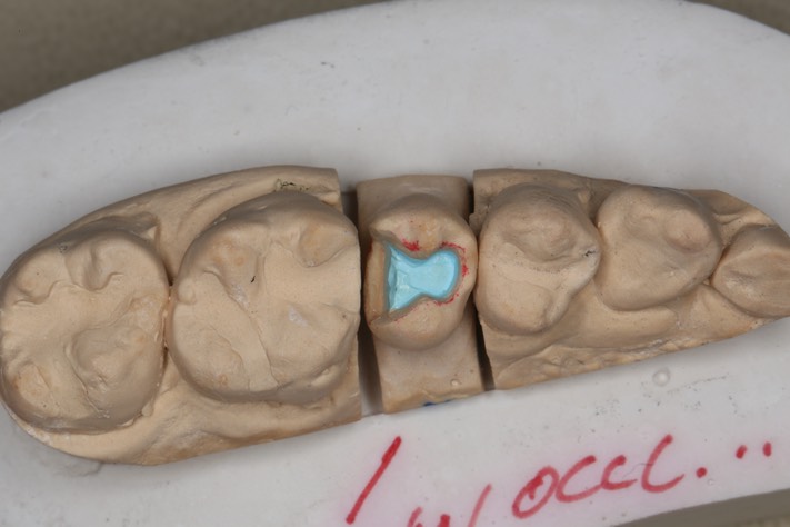 Mitchell Chun #4 model