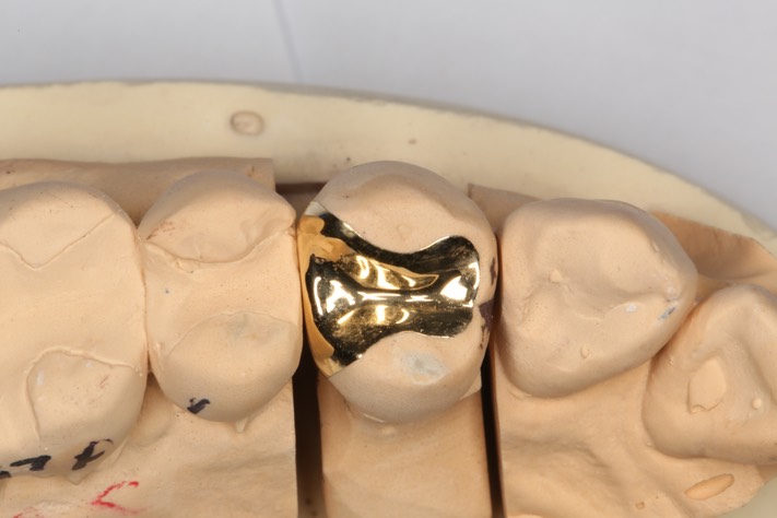 Carla Fukumoto #5 casting on model