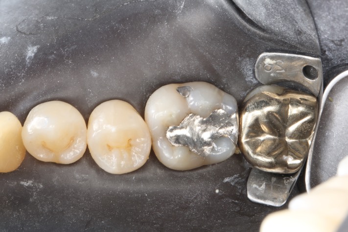 Gary Umeda #30 with dam