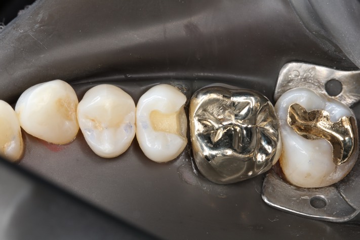 Mason Savage #4 prep