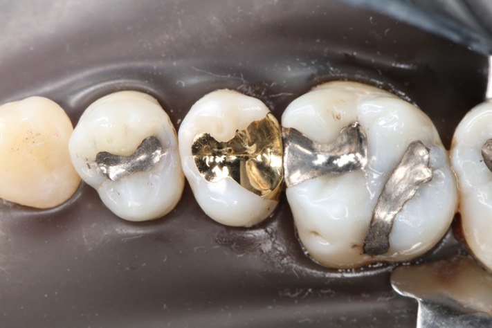 Mitchell Chun #4 finish