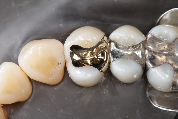 Carla Fukumoto #5 finish