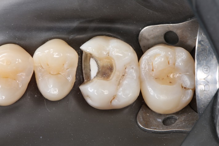 Scott Kanamori #3 prep