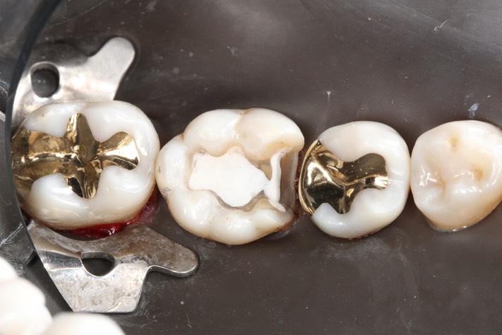 Ted Kanamori #29, 31 finish, #30 prep