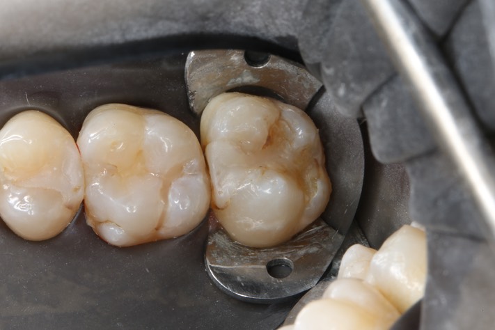 Wayne Chin #2 pre-op