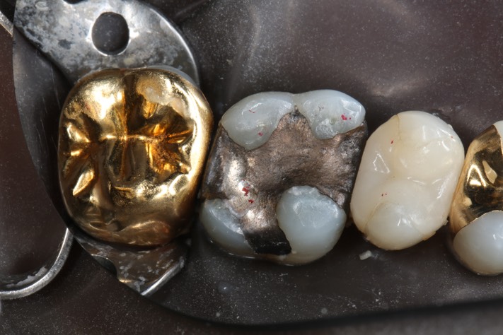 Kyle Chock#14 pre-op