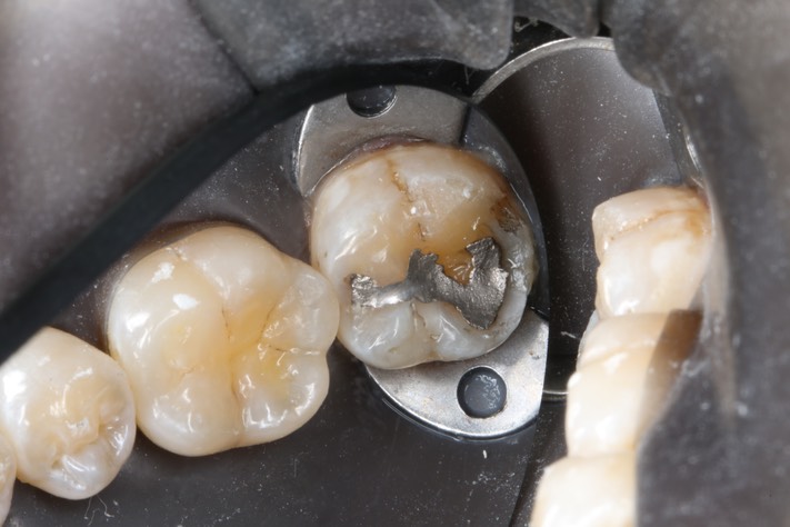 Russ Tabata #18 pre-op