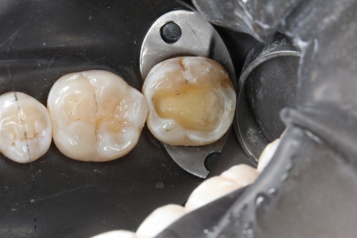 Russ Tabata #18 prep