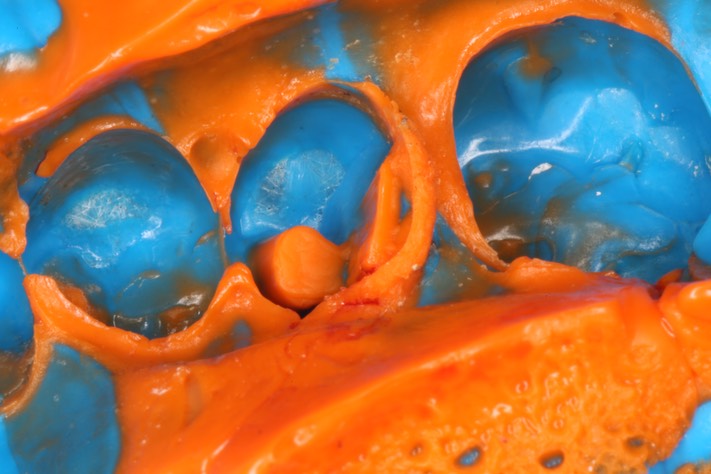 Gary Umeda #20 impression