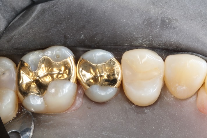 Chris Woo #12 pre-op