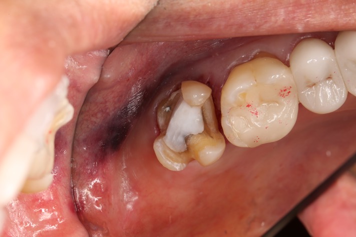 Mendel Sato #15 prep