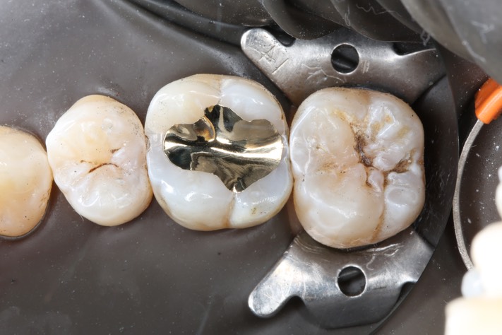 Alan Chinn #3 finish