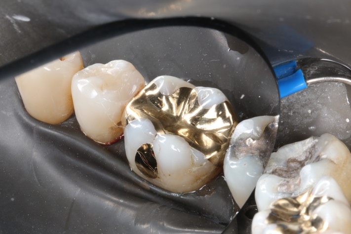 Frank Fukuda #30 combined view