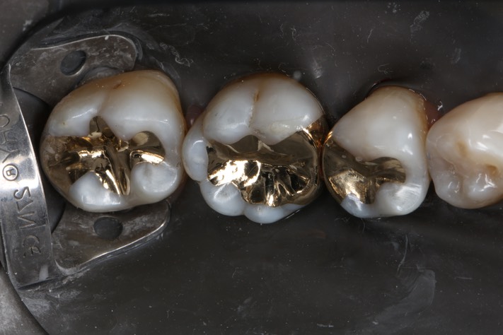 Ted Kanamori #30 finish