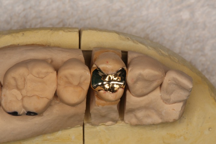 Alan Chinn #5 casting on model