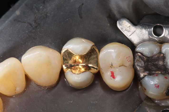 Alan Chinn #5 try in