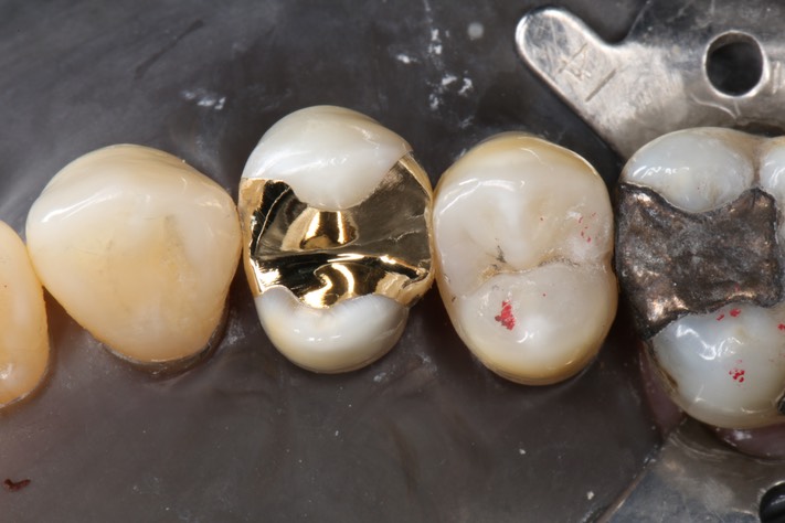 Alan Chinn #5 finish